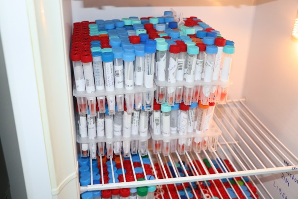 A imagem mostra frascos com amostras de secreção do nariz e boca de pacientes com suspeita de covid-19. 