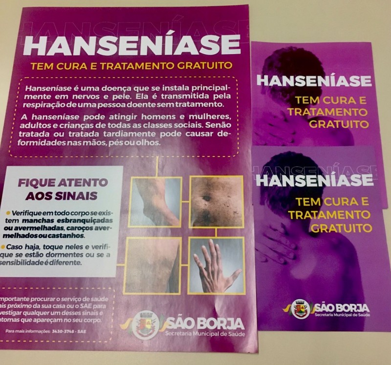 Prefeitura promove ações para alertar sobre sinais e sintomas da Hanseníase