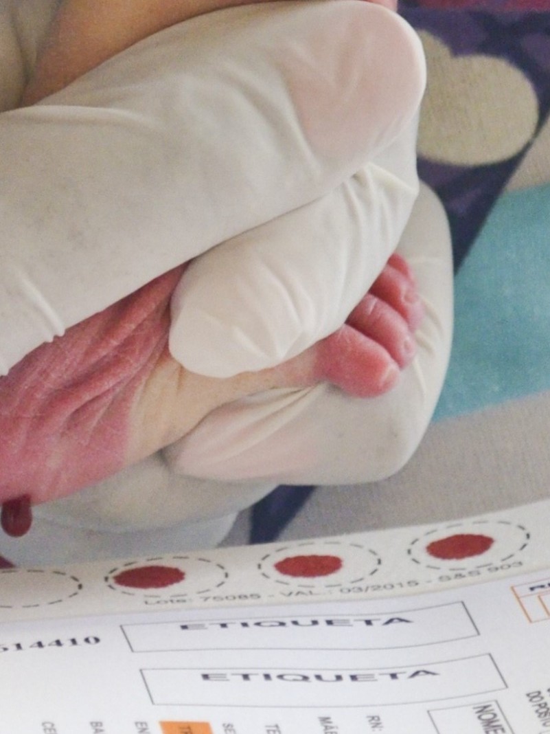 Uma profissional de saúde, com luvas descartáveis, realizando a coleta de sangue do calcanhar de um recém-nascido para o Teste do Pezinho. O bebê está deitado, e a profissional utiliza uma lanceta para realizar a punção, enquanto segura o pé do bebê com cuidado. A cena transmite um ambiente clínico limpo e organizado, destacando a atenção e o cuidado dedicados à saúde neonatal
